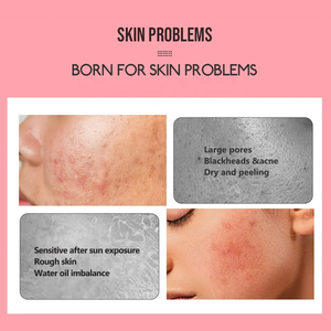 OEM ODM Natural Organic Face Toner Facial Mist Nourishing <strong>Moisturising</strong> Refreshing Rose Water <strong>Spray</strong> - Product Image 4