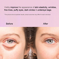 Masques rafraîchissants pour les yeux à la caféine, aux peptides, au collagène et à l'ADN de saumon, patchs hydrogel PDRN pour les yeux gonflés et les cernes