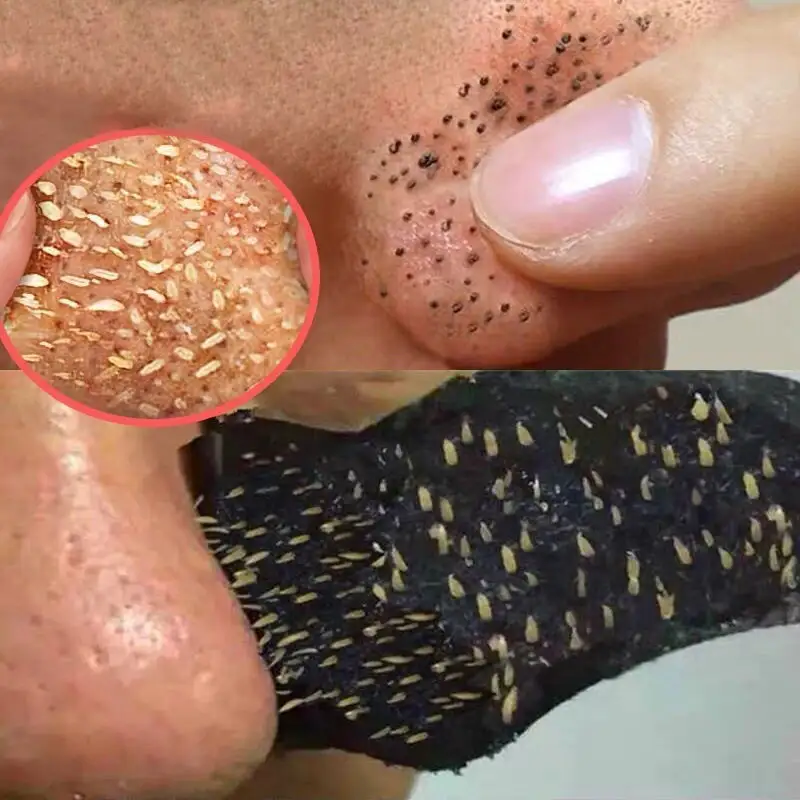 Natural Bambu Carvão Blackhead Remover Máscara Peeling Off Nariz Máscara Rosto Limpeza Poro Tiras