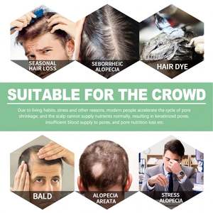 Bola de Masaje Capilar OEM <span class=keywords><strong>West</strong></span> Month Dense Hair, Tratamiento para el Cuero Cabelludo, Hidrata las Raíces del Cabello, Engrosa, Nutre el Cabello - Product Image 5