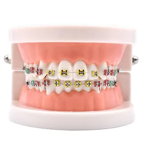 Lage Prijs Hete Verkoop Orthodontische Tanden Model Beugel Model Tandheelkundige Apparatuur