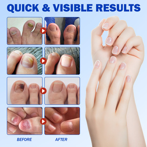 Patch réparateur d'ongles ELAMEI Herbal 8 heures, patch réparateur et protecteur des ongles des orteils contre les champignons - Product Image 6