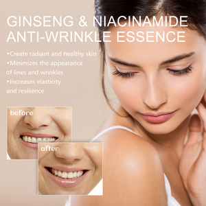 EELHOE Crema Facial Hidratante Antiarrugas y Reafirmante <span class=keywords><strong>para</strong></span> una Piel Delicada, Elástica y Rejuvenecida Alrededor de <span class=keywords><strong>los</strong></span> <span class=keywords><strong>Ojos</strong></span> - Product Image 3