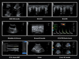 SYA-N7 <span class=keywords><strong>Chariot</strong></span> mobile Doppler couleur, appareil d'échographie professionnel pour diagnostic automobile - Product Image 4
