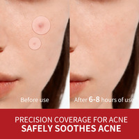 Patchs Hydrocolloïdes Anti-Acné à l'Arbre à Thé et Centella Asiatica pour l'Amélioration des Pores et l'Action Anti-Imperfections, Convient à Tous Types de Peau