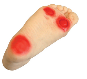 चिकित्सा विज्ञान प्रशिक्षण और नैदानिक उपयोग के लिए BIX-HS19 उन्नत मधुमेह पैर देखभाल मॉडल - Product Image 3