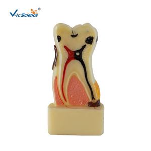 Modelo de Dentes Humanos em Quatro Vezes para Doenças Periodontais, Modelo Educacional em Ciências Médicas - Product Image 1