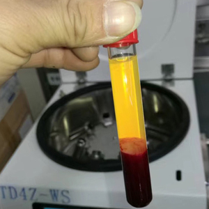 Fabricant de gel de plasma <span class=keywords><strong>PPP</strong></span> (Plasma) TDD-4MC Centrifugeuse pour gel de plasma Machine à fabriquer du gel de plasma - Product Image 5