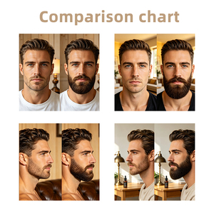 Huile <span class=keywords><strong>de</strong></span> Soin pour <span class=keywords><strong>Barbe</strong></span> OEM, Huile Essentielle Nourrissante pour Hommes, Renforce les Racines <span class=keywords><strong>de</strong></span> <span class=keywords><strong>la</strong></span> <span class=keywords><strong>Barbe</strong></span>, Hydrate et Adoucit - Product Image 3