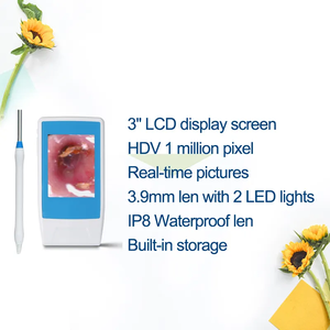 Otoscopio Digital ScopeAround Eléctrico USB Plug and Play de 3.9mm Ultrafino con 6 Luces LED, Certificado CE Clase II para la Eliminación de Cera del Oído - Product Image 3