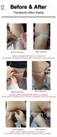 Offre Spéciale : Appareil de Massage Anti-Cellulite 5-en-1 à Rotation 360° et Vibration 5D pour Détoxification, Utilisation à Domicile sur le Visage et le Corps Entier