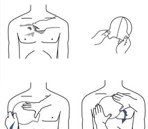 Sello de pecho EMS Kits de trauma Médico DE EMERGENCIA Sello de pecho Apósito Primeros auxilios Respondedores de heridas en el pecho Cuidado de traumatismos Vendaje de rescate - Product Image 5