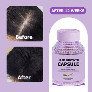 Capsules <span class=keywords><strong>de</strong></span> croissance capillaire en gros à bon prix – Complément alimentaire stimulant la pousse des cheveux plus épais et plus longs, et favorisant la santé globale du corps pour les femmes - Product Image 3