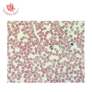 Diapositivas de histología humana Frotis de sangre humana de alta educación Recursos de enseñanza de vidrio transparente Diapositivas de microscopio preparadas con tejido humano - Product Image 5