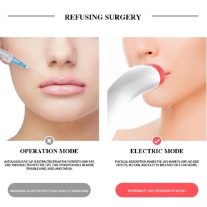 Appareil de repulpage des lèvres portable rechargeable par USB pour salon de beauté, équipement de repulpage des lèvres pour femmes - Product Image 2