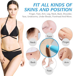 Kit ALIVER per Rimozione Verruche e Nevi Cutanei, Penna Professionale per Rimozione Rapida di Nevi Cutanei su Viso e Corpo, Etichetta Privata - Product Image 4
