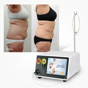 Clinic used Laser 980 1470 Wrinkle reduce Face skin Lifting Lipolysis Fat reduction body shape laser 980 1470nm