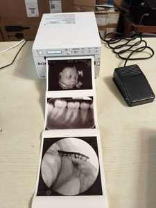 Imprimante thermique directe pour imagerie médicale, imprimante de films médicaux, imprimante SONY pour appareil d'échographie - Product Image 3