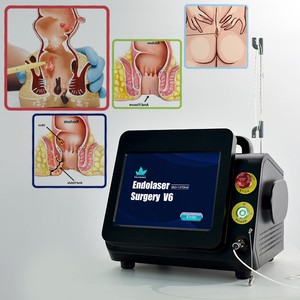 Eliminación Efectiva de Hemorroides, Tratamiento Láser de Alta Potencia 980+1470nm, Dispositivos Quirúrgicos para Hemorroides Externas - Product Image 4
