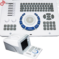 Équipement portatif portatif de sonographie d'ultrason de Full Digital avec des options multiples de sonde pour la pratique générale
