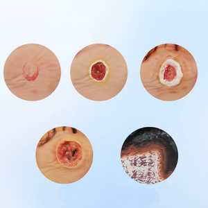 Modèle de pied diabétique en silicone de haute qualité avec ulcères purulents pour l'enseignement infirmier - Product Image 2