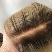 Peluca de Cabello Humano Virgen Europeo con Frente de Encaje, Línea de Cabello Natural, Color Rubio Platino Ombre, Encaje Suizo HD, para Mujeres Blancas
