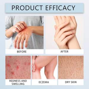 <span class=keywords><strong>Eczema</strong></span> Relief Cream, <span class=keywords><strong>Eczema</strong></span> Healing Blend-Alivio DE LA PIEL calmante natural <span class=keywords><strong>para</strong></span> secar, hecho con ingredientes orgánicos - Product Image 6