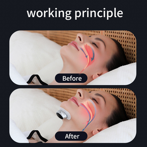 Alat Bantu Tidur <span class=keywords><strong>Anti</strong></span> Dengkuran EMS Pintar Elektrik Terbaru 2023, Perangkat <span class=keywords><strong>Anti</strong></span> Dengkuran Elektrik Tens, Penghenti Dengkuran Elektrik - Product Image 4