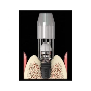 Neobiotech R-Brush เครื่องมือทันตกรรมรากฟันเทียมแปรงไทเทเนียมกำจัดสิ่งปนเปื้อนบนพื้นผิวเครื่องมือทันตกรรมรากฟันเทียม - Product Image 4