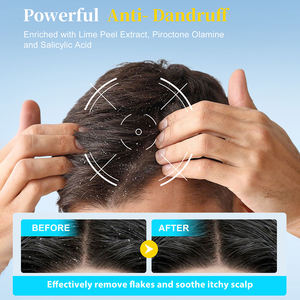 แชมพูควบคุมความมันสำหรับผู้ชาย ทำความสะอาดหนังศีรษะ ขจัดรังแค บรรเทาอาการคัน แชมพูขจัดรังแค - Product Image 4