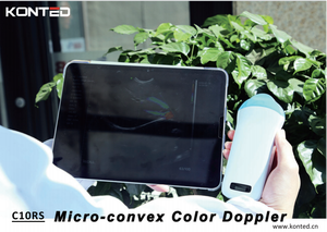 Konted MDR Sản phẩm bán nóng mua micro-lồ<span class=keywords><strong>i</strong></span> siêu âm DOPPLER màu đầu dò máy - Product Image 6