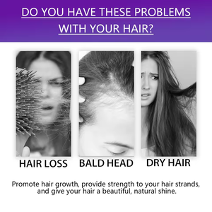 Оптовая продажа, низкая цена, Новое поступление, 100% натуральное органическое черное масло для ухода за волосами кожи - Product Image 5