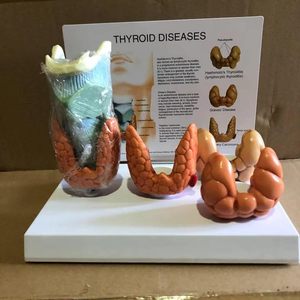 4 orta tiroid ve larinks insan anatomisi tiroid hastalıkları Thyoid sistem modeli tiroid anatomik Model seti - Product Image 2
