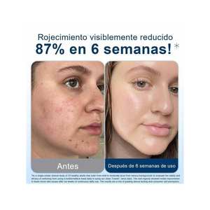 Toallas Desechables Shesmile Clean Towels XL, Paquete de 50 Unidades, para Desmaquillar el Rostro - Product Image 2