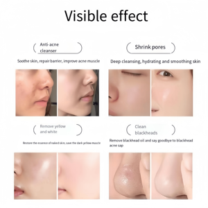 Appareil de beauté multifonctionnel de bureau en plastique Demaso 4ème génération, revitalisant cutané anti-âge, mésothérapie Vital Body - Product Image 4