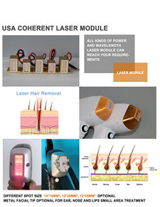 2023 Laser Beste Professionele Diode Laser Ontharing 755nm 808nm 1064nm Diode Laser Ontharing Machine Prijs - Product Image 5