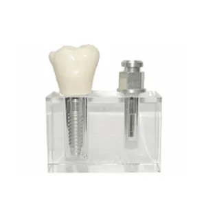 Modelo dental 5 vezes transplante de dentes para comunicação médico-paciente
