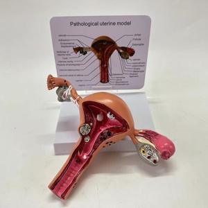 Modelo de Patología del Útero Humano para Ciencias Médicas, Modelo de Enfermedad Órgánica, Modelo Antidrogas - Product Image 3