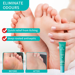 B.I.R.D OEM Customized <strong>Antifungal</strong> Foot <strong>Cream</strong> with Plant Extract for Infection Relief Dry Cracked Skin Repair Inhibit Bacteria - Product Image 5