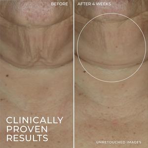 皮膚フェイシャルセラムカスタマイズレチノールファーミングセラムスティックしわ防止修理 - Product Image 2