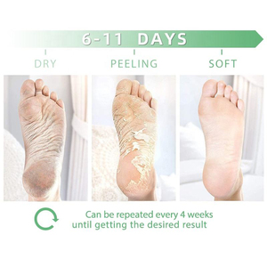 Masque exfoliant pour les pieds, élimination des peaux mortes, pédicure, soin des callosités et des talons fendillés - Soin des pieds en chaussette avec acide lactique et glycolique - Product Image 3