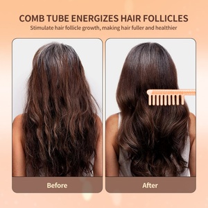 Appareil de soin du visage à haute fréquence avec logo personnalisé pour usage domestique, SPA, galvanique, orange, bleu, violet, anti-âge, thérapie cutanée - Product Image 3