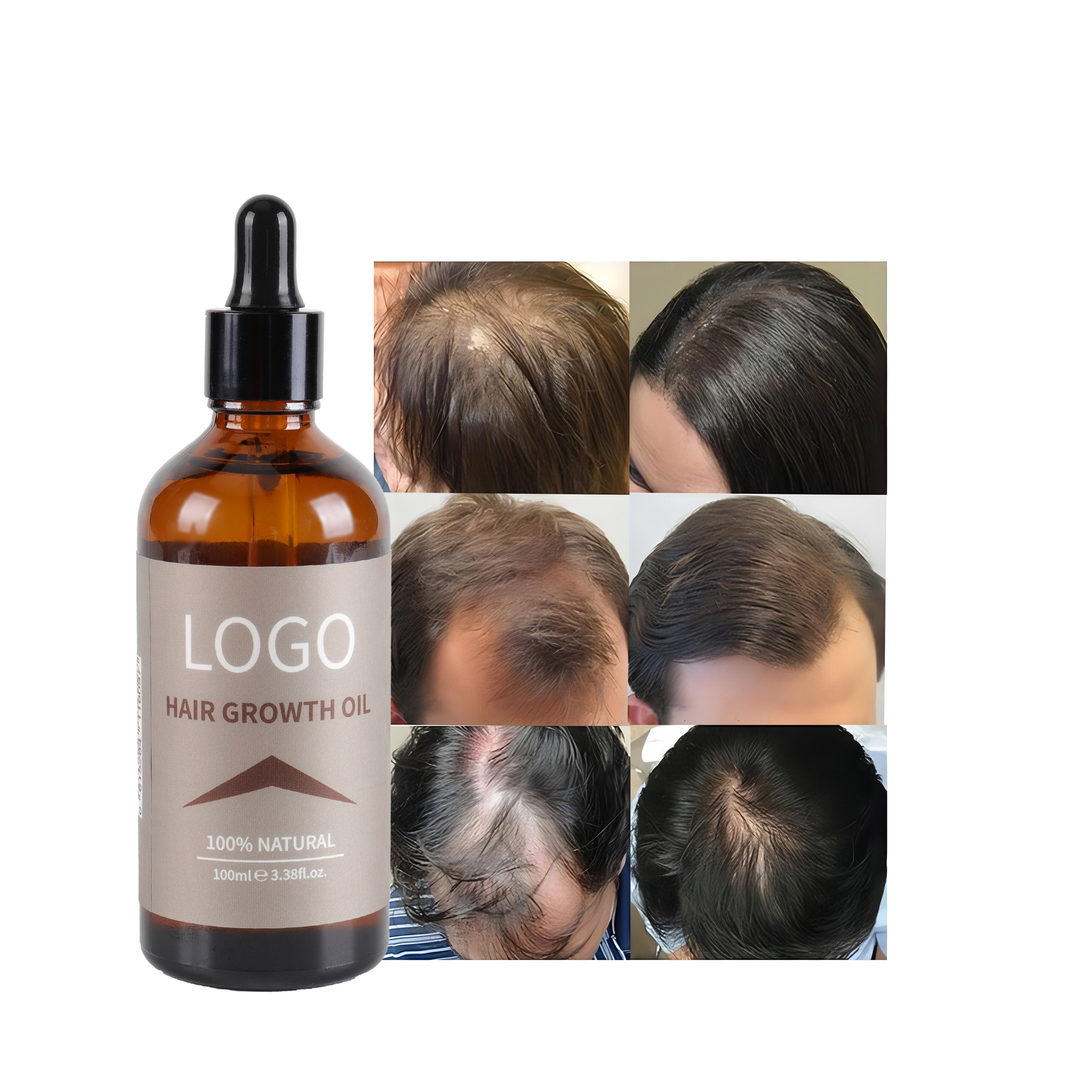 Высокое качество, эфирное масло розмарина, сыворотка для роста волос, натуральное чистое органическое кокосовое масло, масло чайного дерева, стеклянная бутылка или по индивидуальному заказу