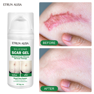 ETRUN ALISA Marque privée <span class=keywords><strong>Gel</strong></span> en <span class=keywords><strong>silicone</strong></span> pour enlever les cicatrices anciennes et nouvelles cicatrices d'acné <span class=keywords><strong>Gel</strong></span> topique lisse pour éliminer l'acné pour les soins de la peau - Product Image 3