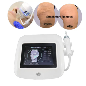 Appareil de beauté portable à micro-aiguilles RF pour lifting du visage, élimination des vergetures, raffermissement de la peau et réduction des rides - <span class=keywords><strong>Prix</strong></span> - Product Image 4