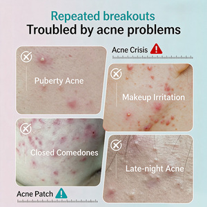 แผ่นปิดสิว AUSLKA Beauty Invisible Concealer Acne Patch Magic Tool ไม่เหนียวเหนอะหนะ บำรุงผิว ปิดสิว รอยสิว โปร่งใส - Product Image 2
