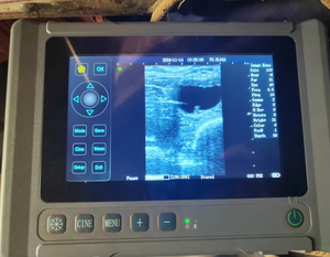 Échographe vétérinaire portable à écran tactile de 8 pouces pour l'examen rectal de la gestation des bovins, des chevaux, des moutons et des porcs - Product Image 2