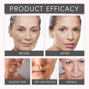 EELHOE 50g <span class=keywords><strong>crema</strong></span> complessa peptide idratante rassodante levigante lifting anti invecchiamento anti rughe <span class=keywords><strong>crema</strong></span> <span class=keywords><strong>per</strong></span> il <span class=keywords><strong>collo</strong></span> - Product Image 4