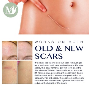 Professional Silicone Scar Removal Cream Gel Effective for Keloid Scar Removal Best Stretch Mark Cream for Legs and Thighs - Product Image 2