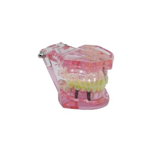 Modelo de Entrenamiento de Implantes Dentales (1 Unidad) con Dientes Removibles y Demostración de Patología para Práctica de Implantes y Restauración de Puentes - Product Image 4